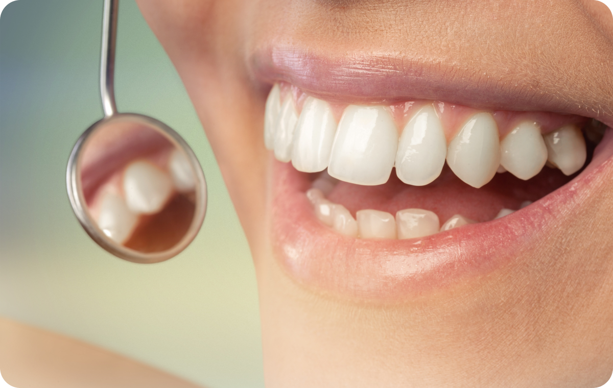 Processus de parodontologie